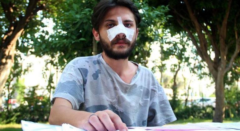 Antalya’da kiracı gence ucuz kira dayağı Tekme tokat vurup, burnunu kırdılar