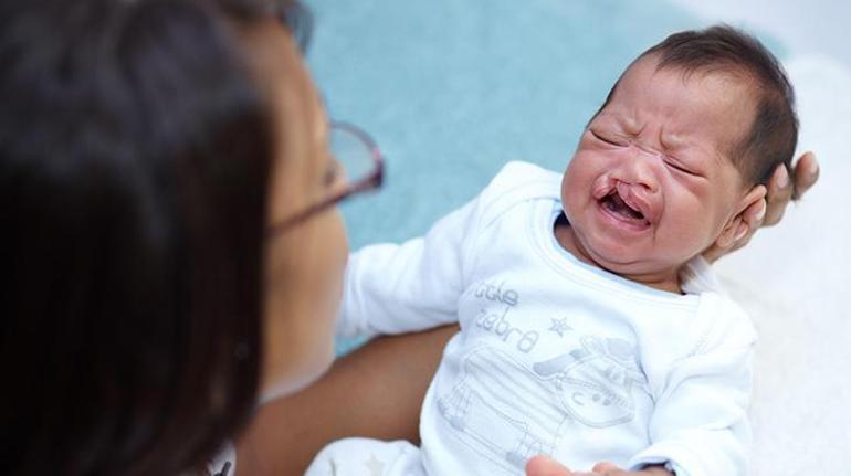 İlk 48 saat hayati önem taşıyor Bebekler en az 10 haftalık olduğunda ameliyat yapılabilir