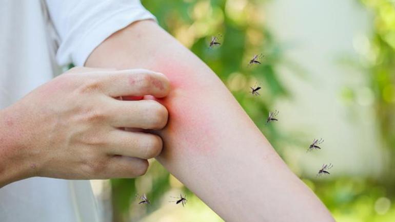 Yazı, kışı yok: Ne kadar sivrisinek varsa üzerine yapıştı 1 muz bile yetiyor