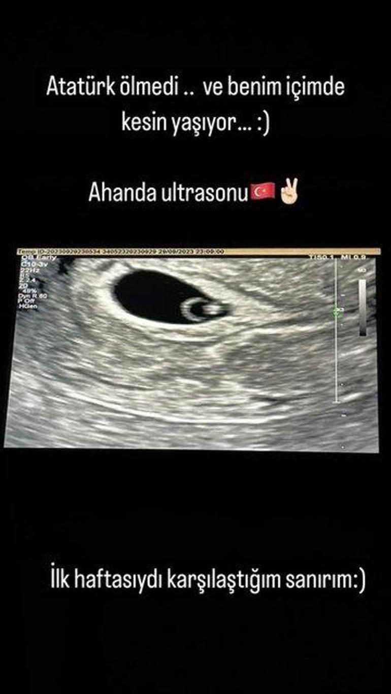 Gonca Vuslateri, ultrason görüntüsünü paylaştı