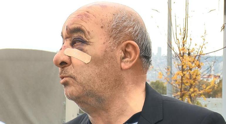 Taksici dehşeti yaşadı Dikiz aynasını kırıp önce öldüresiye dövdü sonra gasp etti