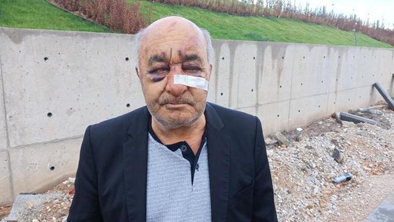 Öldüresiye dövülen taksici dehşeti anlattı: Gözümün merceği kaydı