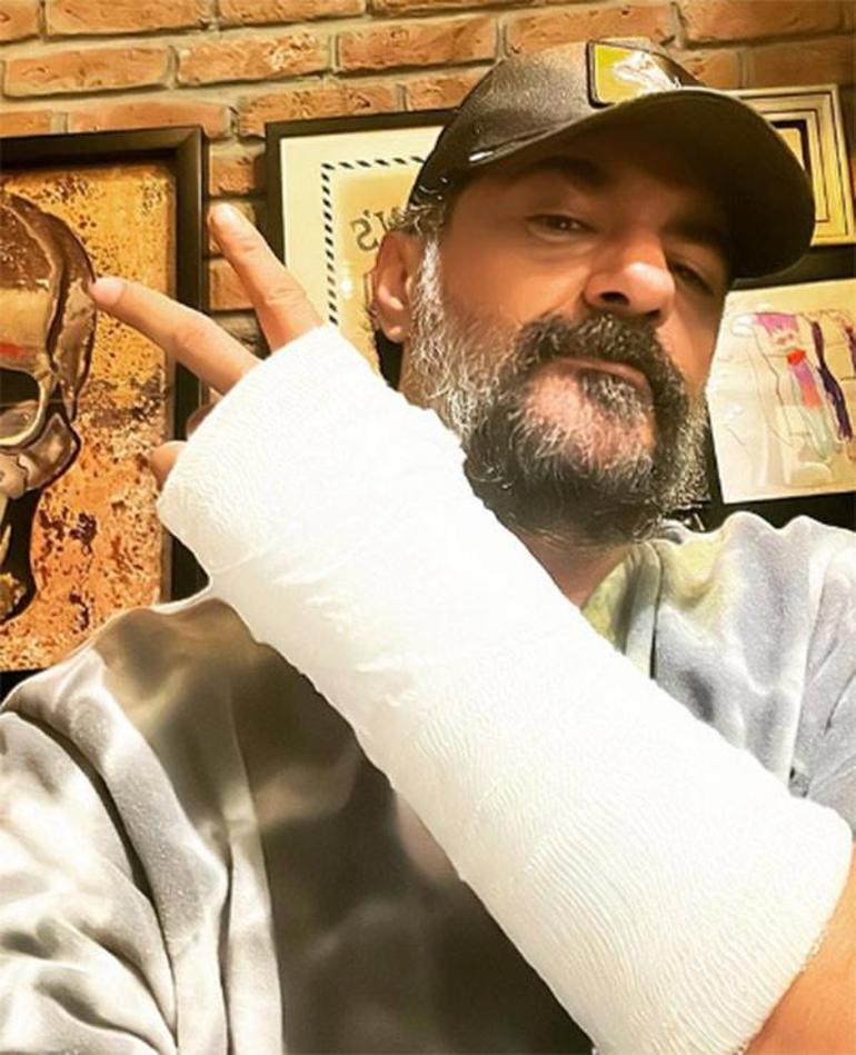 Celil Nalçakan set kazası geçirdi Ünlü oyuncunun sağlık durumu