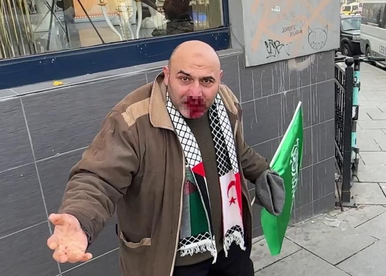 Filistine destek yürüyüşünden dönen vatandaşa yumruklu saldırı