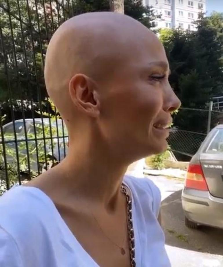 Beyninde tümör tespit edilen Şarkıcı Şimal ameliyata girdi