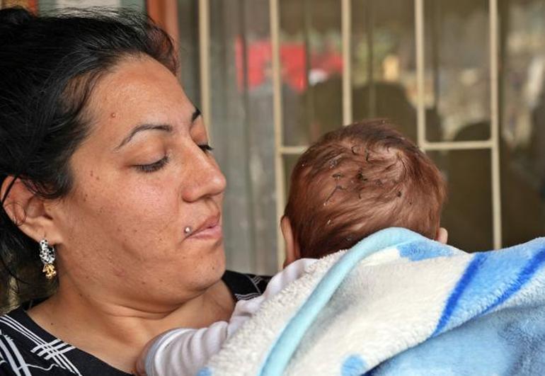 Sara hastası dayı 2 aylık Can bebeği alevlerin arasından aldı