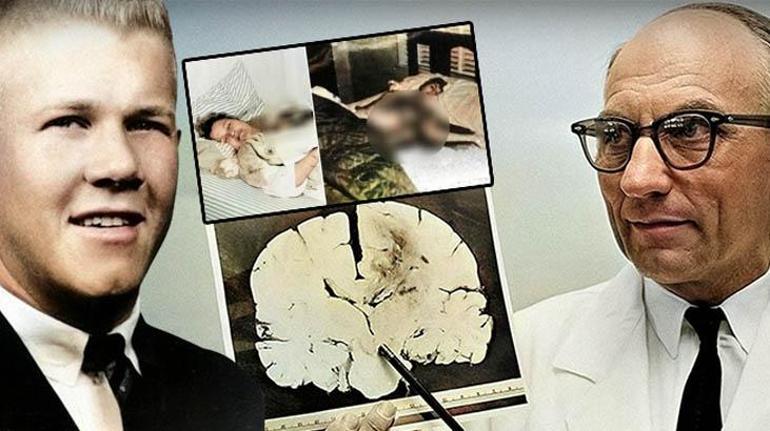 Tek bir günde 18 ölü, 31 yaralı Katliamın sebebi beynindeki tümör mü