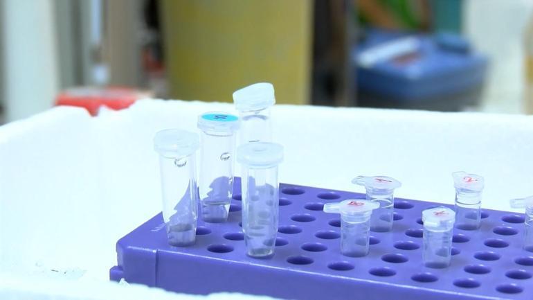 SMA tedavisinde Türkiyede bir ilk: Kök hücre temelli test