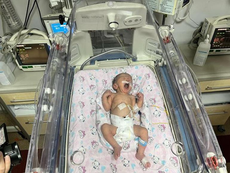 Doktorların ‘yaşaması imkansız’ dediği bebek mucizeyi yarattı