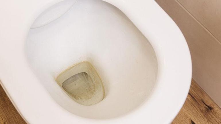 Tuvalet temizlerken herkesin yaptığı hata Bakteri yuvasına çeviriyor