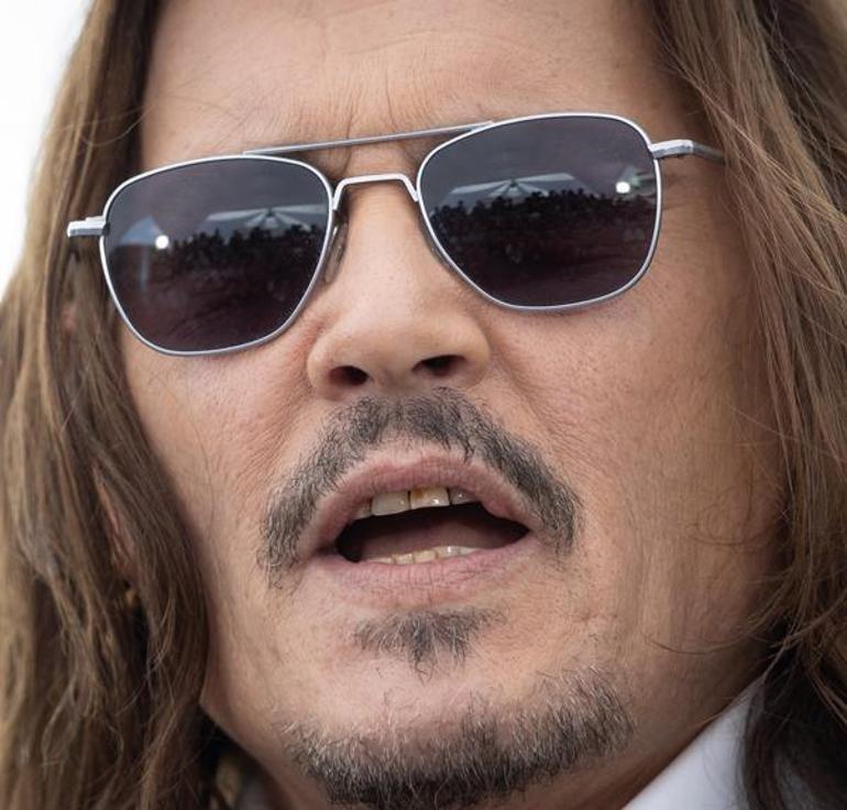 Dişlerinin hali olay olmuştu Johnny Depp gülüşünü yeniledi