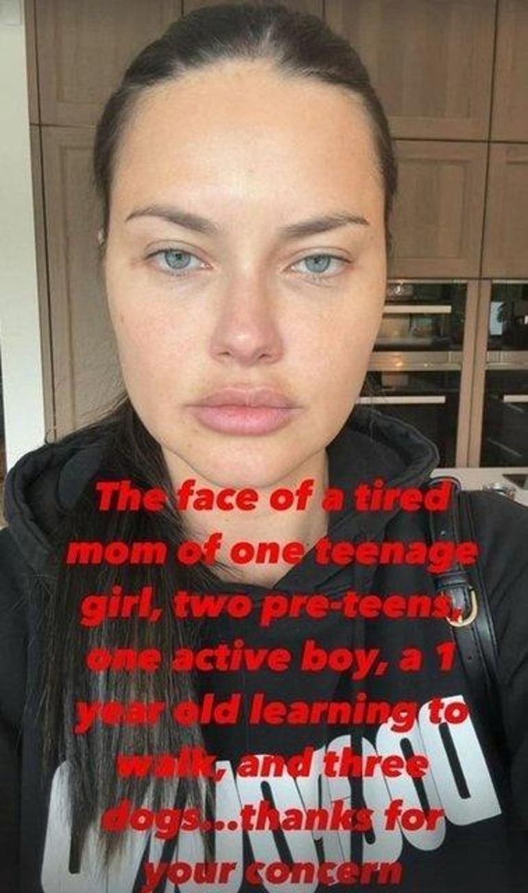 Yüzündeki değişim olay olmuştu Adriana Lima geri döndü