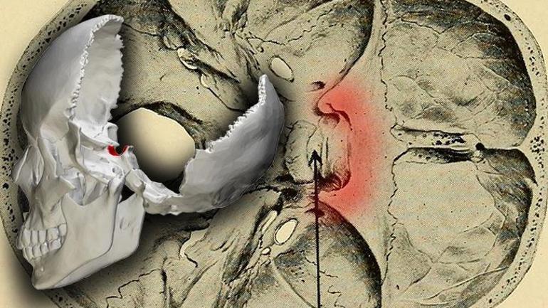 Türkün eyeri dünyayı koruyor Kafatasındaki hazine: Her şeyin kontrolü gizli kutuda