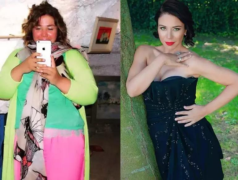 9 ayda 70 kilo verdi, görenler tanıyamadı Adeta iğne ipliğe dönen ünlü şarkıcının son haline bakın