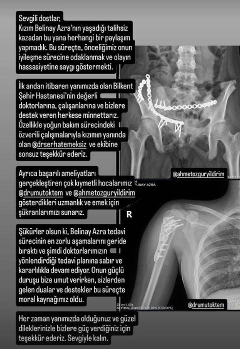 Survivorın eski yarışmacısının kızı 8.kattan düşmüştü Günler sonra ilk paylaşım