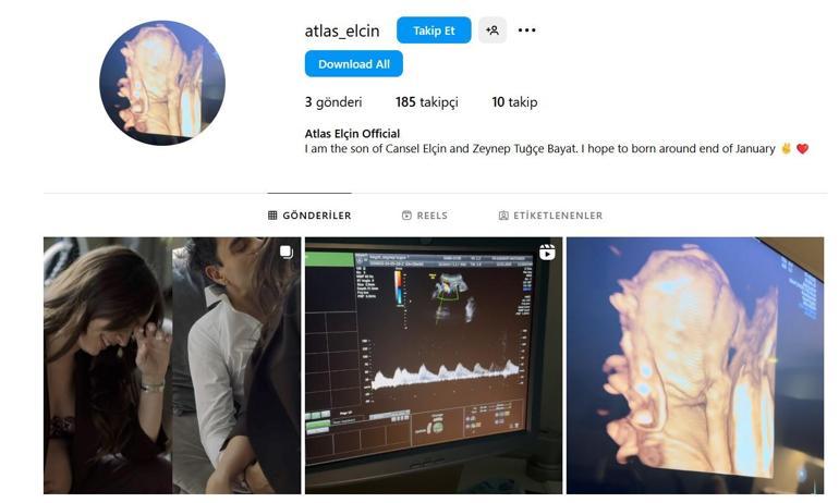 Doğuma günler kaldı Cansel Elçin ile Zeynep Tuğçe Bayat, bebekleri için sosyal medya hesabı açtı