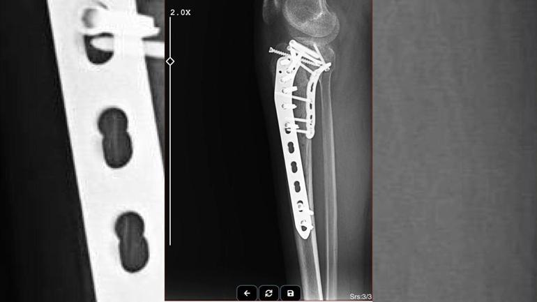 Haciz işleminde kapıda saldırıya uğradı, bununla da bitmedi Dolmuşta korkunç an