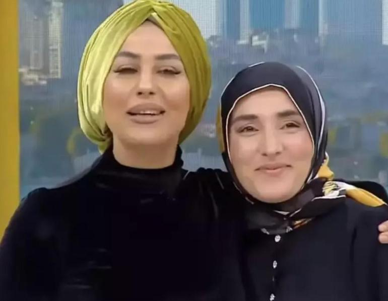 MasterChefin gözde yarışmacılarından biriydi Ayşe Ekizin estetikli görüntüsü şaşırttı