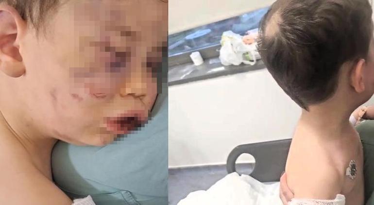 2 yaşındaki bebek annesinin erkek arkadaşı tarafından öldüresiye dövüldü