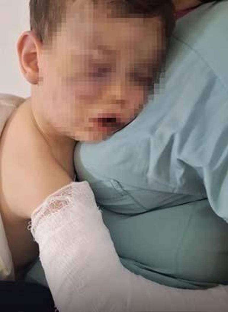 Caniler gözaltında Devlet korumasına alınan 2 yaşındaki Aren bebek ameliyat edilecek