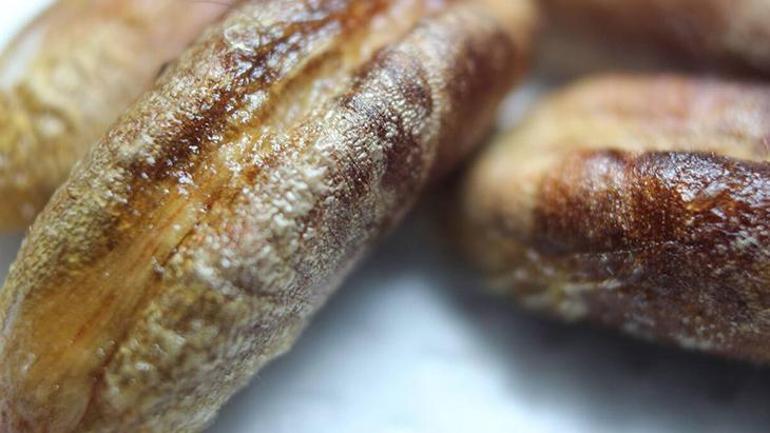 Karın ağrısı sandı, meğer taşmış Hurma ile zeytin tek suçlusu: Kimse yutmasın