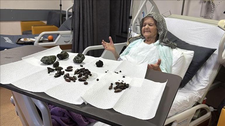 Karın ağrısı sandı, meğer taşmış Hurma ile zeytin tek suçlusu: Kimse yutmasın