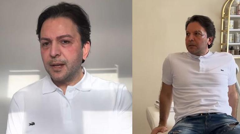 Nihat Doğanı gören tanıyamadı Estetikli yeni hali herkesi şoke etti