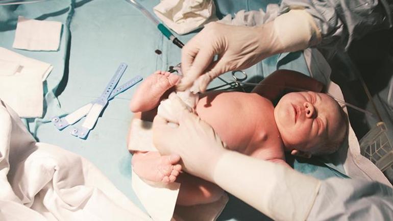 Son yıllarda yenidoğan sünneti tercih ediliyor Her bebek için uygun mu