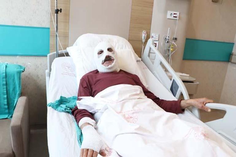 Gaz kaçağını çakmakla kontrol etti, bu hale geldi: O durumda hiç acı hissetmiyordum