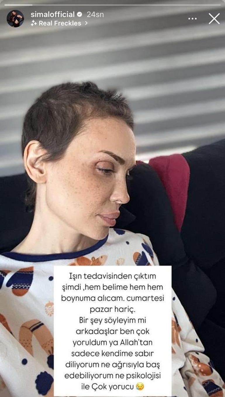 Işın tedavisinden çıkan Şimalden ilk açıklama Ben çok yoruldum