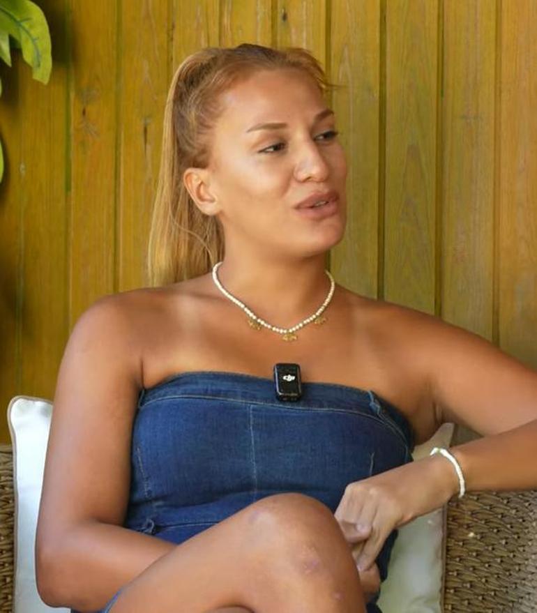 Survivor Almeda, ilk kez açıkladı İşte diskalifiye olayının perde arkası: Meğer yarışma başlamadan önce...