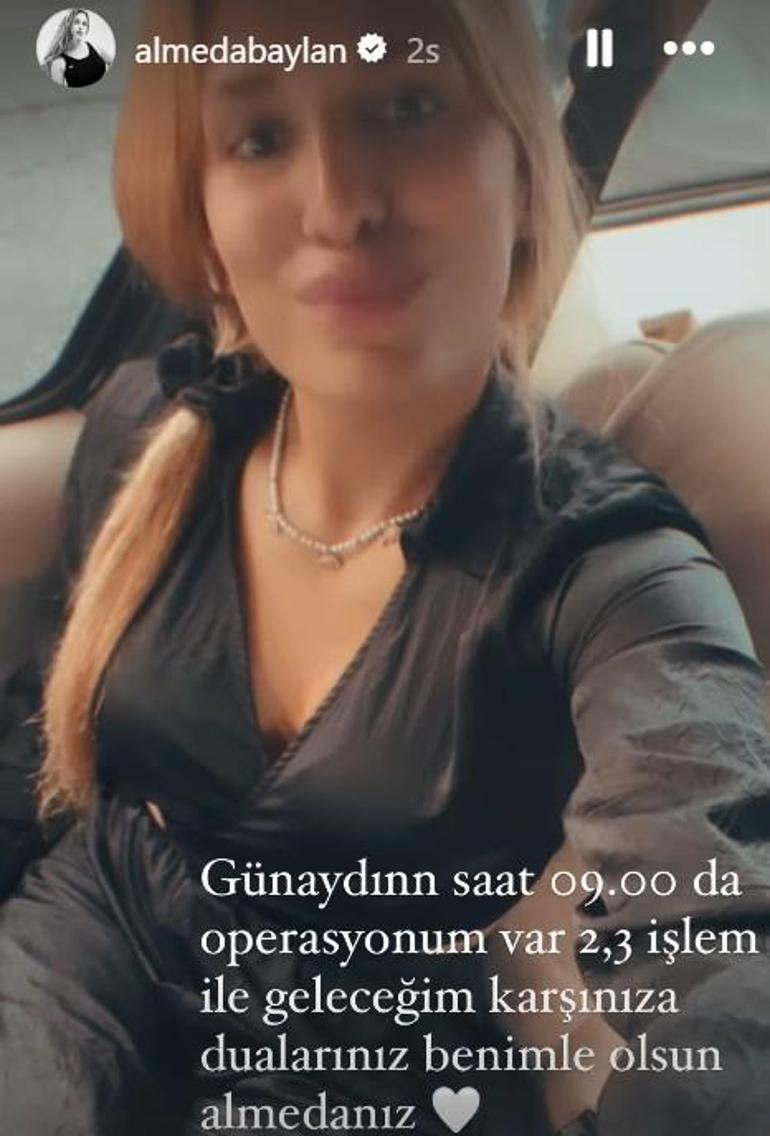 Almeda Baylan estetik ameliyatı mı olacak Saat vererek sosyal medyadan paylaştı