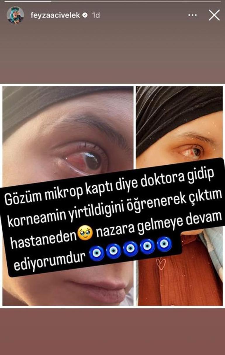 Feyza Civelekin başına gelmeyen kalmadı Kolundan sonra şimdi de gözü