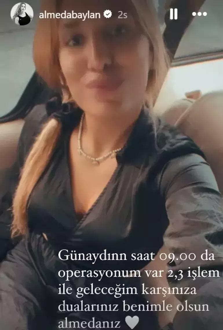 Almeda Baylan estetik ameliyatı oldu Operasyon sonrası ilk görüntüsü ortaya çıktı