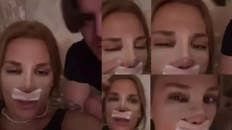 Elendikten sonra ilk iş estetik ameliyatı olmuştu Survivor Almeda Baylan son halini paylaştı