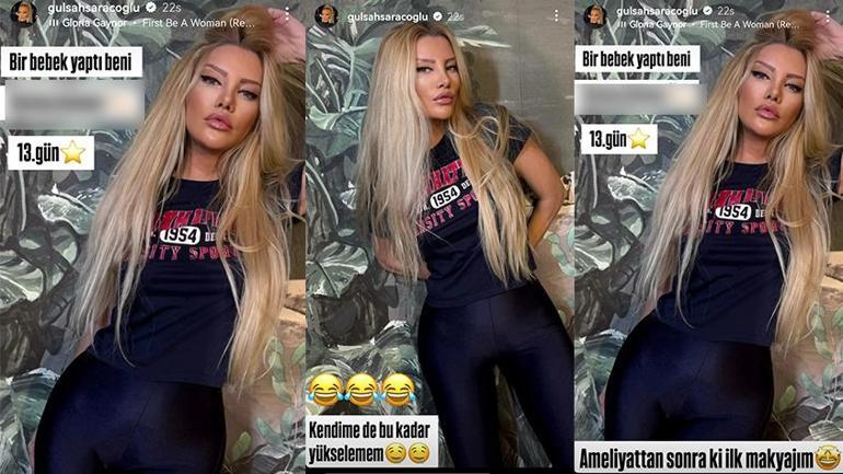 Bıçak altına yatan Gülşah Saraçoğlu bambaşka biri oldu Estetik sonrası son haline bakın