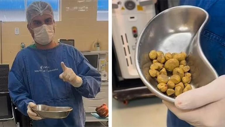 Su yerine 3 litre kola içti Yaşadıkları korkunç, günlerdir rekor kırıyor: Tarlaya dönmüş