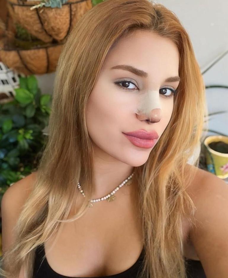 Survivor Almeda Baylandan boşanma açıklaması Gelen sorulara sinirlendi