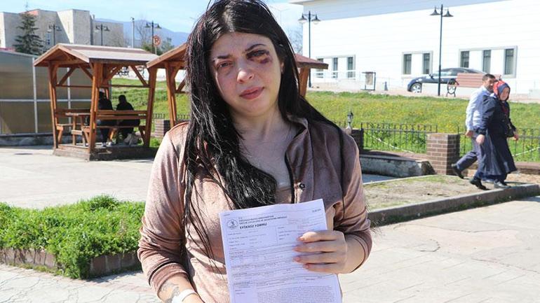 Sokak ortasında taciz edip döndü, 12 suç kaydı ortaya çıktı Şok karar