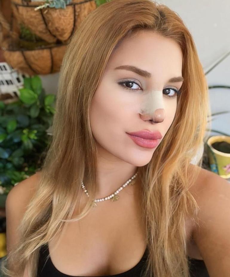 Almeda Baylan iddialar sonrası sessizliğini Instagramdan bozdu İftiralar için dava açıyoruz