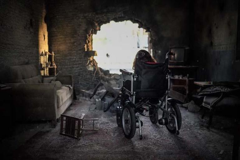 Elleri ve ayakları sırtına yapışık doğdu Her şey ailesinden gizli İstanbuldan Düzceye gitmesiyle başladı
