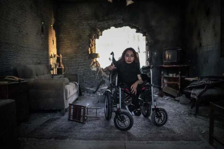 Elleri ve ayakları sırtına yapışık doğdu Her şey ailesinden gizli İstanbuldan Düzceye gitmesiyle başladı