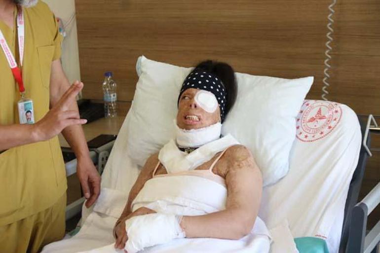 Tatlı sözlere kanmayın diyerek kabusu anlattı: Bergene benzer bir hikayesi var