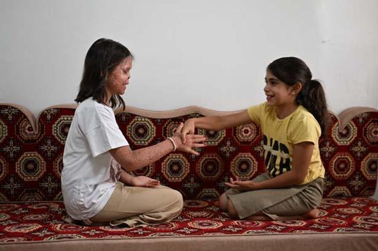 10 yaşında, karanlık odada hayata tutunmaya çalışıyor: Cemilenin güneşi Emine oldu