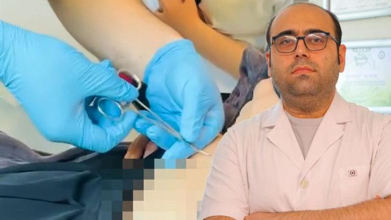 ‘Göbeğimde şişlik var’ dedi, doktorlar şoke oldu Fark etmeden günlerce taşıdı