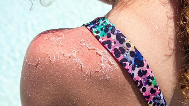 Children under the age of 5 are especially at risk. Do not take them out during these hours.