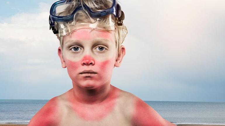 Children under the age of 5 are especially at risk. Do not take them out during these hours.