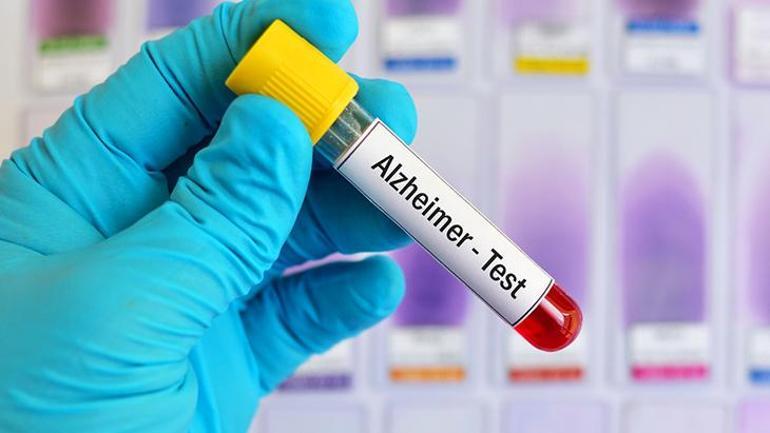 Alzheimera umut olacak keşif Hastalığı tetikleyen mekanizma çözüldü