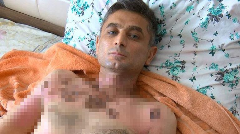 Yer: İstanbul... Telefon gaspıyla başladı, dehşetle devam etti: Benzin döküp yaktı…
