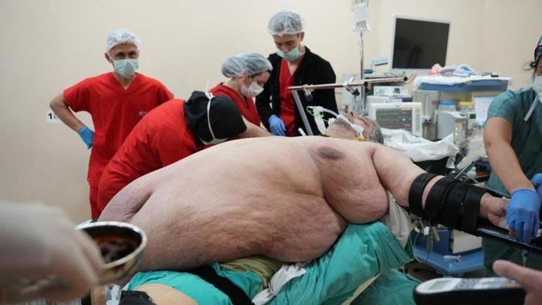 6873503a407805e46c03a35d 310 kiloya ulaştı! “Ölmek için dua ettim” dedi, yıllar sonra ilk adım